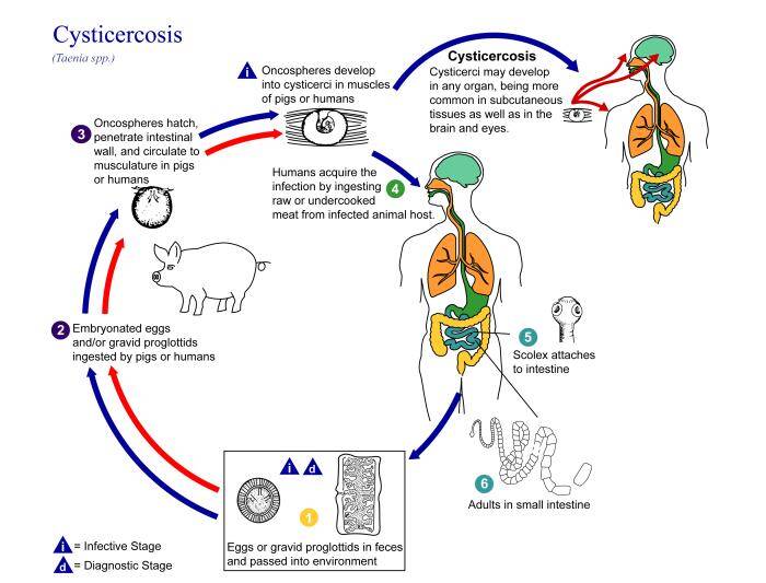 Infección por Cysticercus cellulosae
