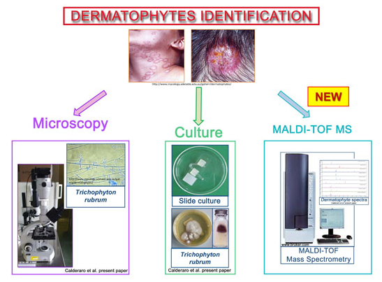 Identificación de infecciones por dermatofitos