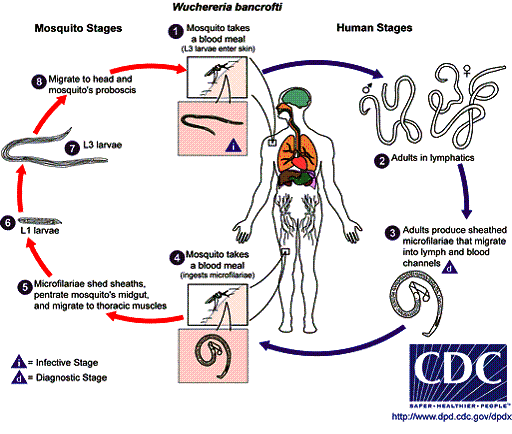Filariasis (Wuchereria bancrofti y Brugia malayi)