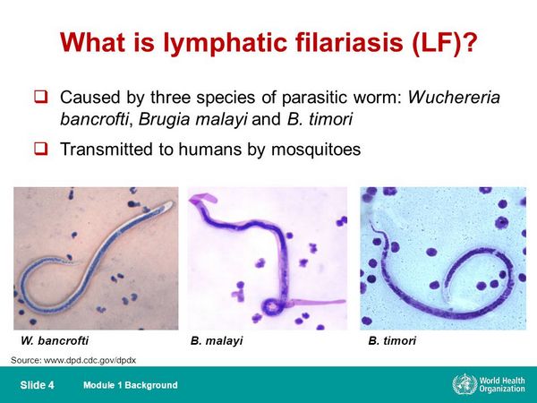 Filariasis (Wuchereria bancrofti y Brugia malayi)