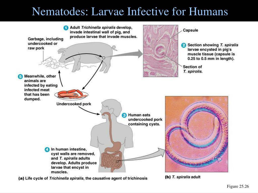 Larvas de nematodos infecciosas para los seres humanos