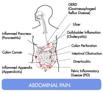 Dolor abdominal