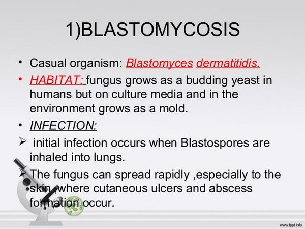 Blastomicosis por ketoconazol